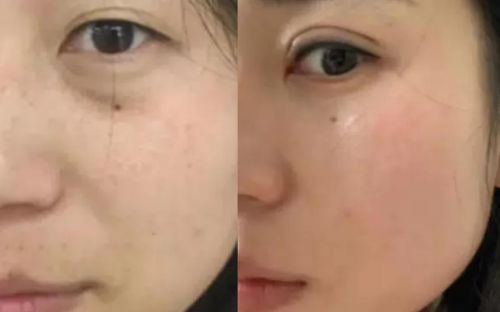 好？抗皱新风尚：紧致面霜十大AG真人网页紧致抗皱面霜哪个(图4)