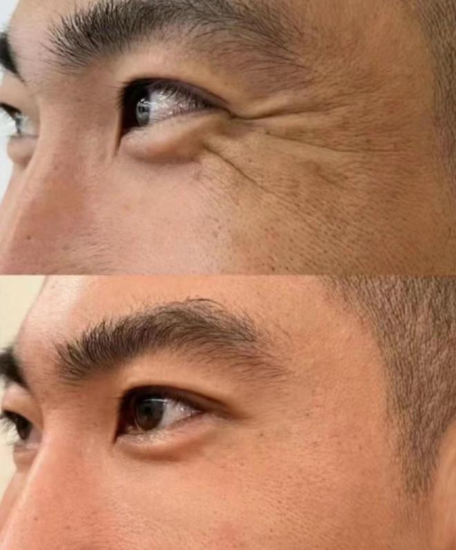 肤品推荐这几款口碑不可错过AG真人中国抗皱紧致的护(图3)